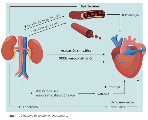 AXON COMUNICACION, Miocardiopatía hipertrófica hipertensiva. Síndrome renocardiaco de tipo IV