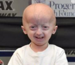 Axon Comunicacion, Crean el primer modelo animal con progeria de Hutchinson-Gilford