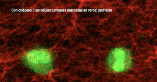 AXON COMUNICACION, Así permanecen ‘dormidas’ las células tumorales antes de provocar la metástasis