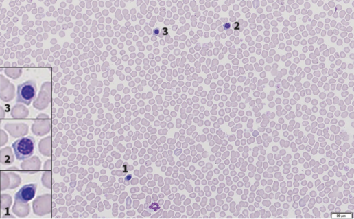 Neutrófilos botrioides y rubricitosis inapropiada en un perro, foto neutrofilo