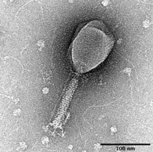 Los virus que infectan a bacterias pueden comunicarse entre sí para establecer estrategias de contagio, según un estudio, foto enterobacteria