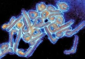 Ghana confirma sus primeros dos casos del virus de Marburgo, similar al ébola, foto virus Marburgo