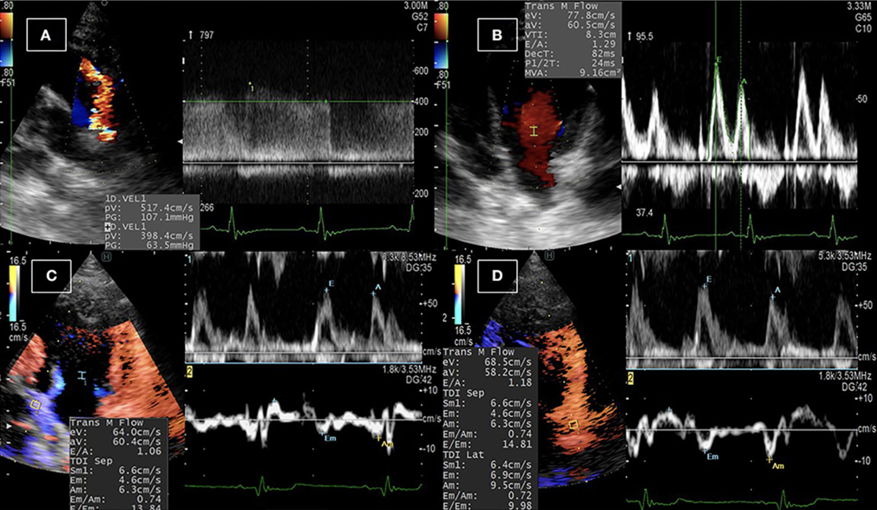 Ecocardiografía de color en modo M para la evaluación no invasiva de la presión intraventricular en perros antes y después de la oclusión del conducto arterial: un estudio retrospectivo, foto Examen ecocardiográfico convencional en perros con PDA