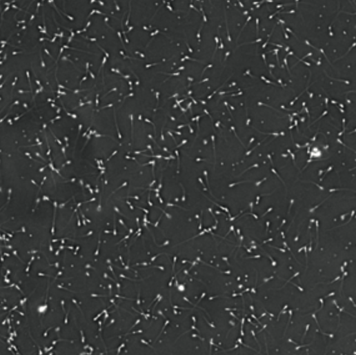Usos potenciales del ácido docosaexaenoico (DHA) en cría y reproducción, foto de Espermiograma con oligoespermia