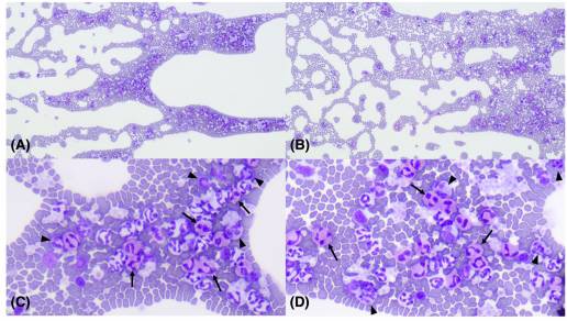 Caso clínico-plasmocrítico y eosinofílico enterocolitis presentada con marcada eosinofilia y basofilia en un gato