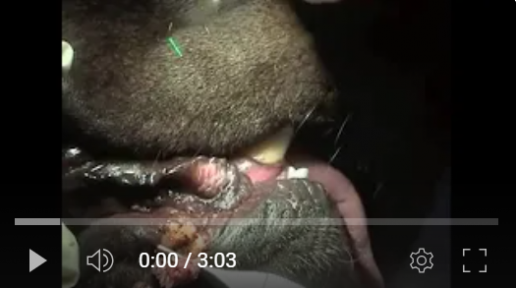 Cirugía de papilomatosis viral con láser