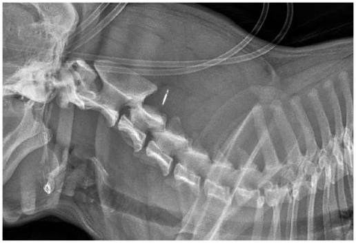 Caso clínico: Mielopatía cervical hemorrágica traumática en un perro