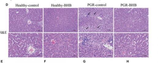 La administración de β-hidroxibutirato mejora la lesión hepática y la anomalía metabólica en lechones con retraso de crecimiento postnatal