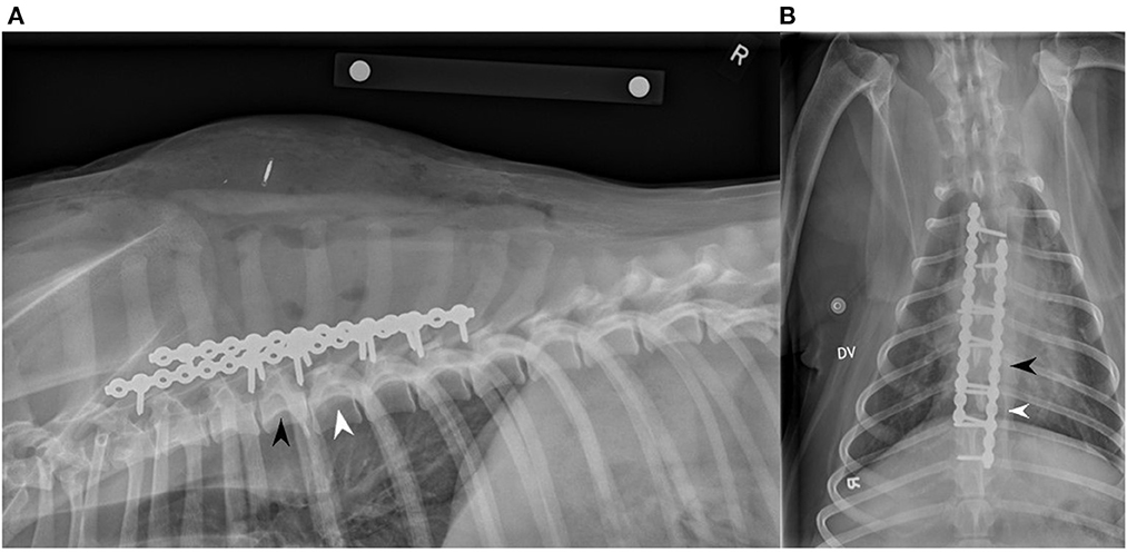 Tracción diagnóstica y estabilización de la placa de bloqueo dorsal de una quinta y sexta fractura/luxación vertebral torácica en un golden retriever: Caso clínico