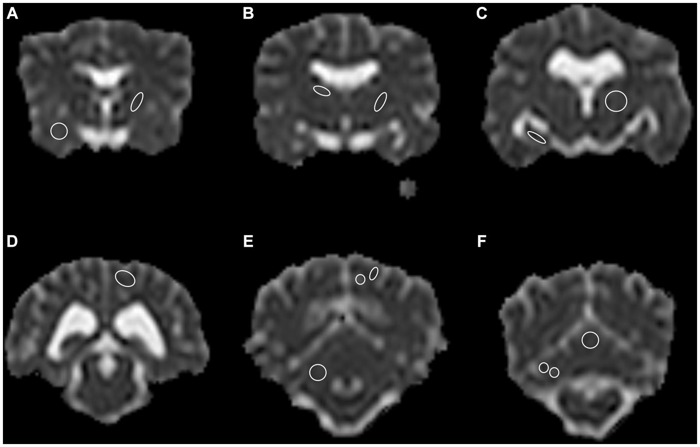 Valores regionales de ADC del cerebro canino morfológicamente normal
