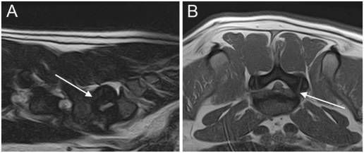 Prevalencia, hallazgos de la resonancia magnética y características clínicas de la protrusión del disco intervertebral lumbosacro en bulldogs franceses diagnosticados de extrusión aguda del disco intervertebral torácico o lumbar
