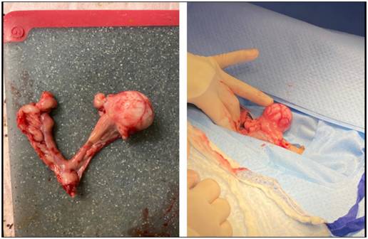 Caso clínico: Caso de leiomiosarcoma oviductal y uterino en una perra de 11 años