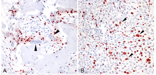Sarcomas de partes blandas caninas: la expresión de RUNX2 y carioferina alfa-2 en osteosarcomas extraesqueléticos (tejidos blandos) y esqueléticos