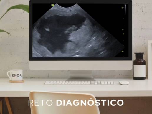 Ecografía abdominal de un Schnauzer miniatura de 9 años, macho castrado, con un cuadro de polaquiuria y hematuria
