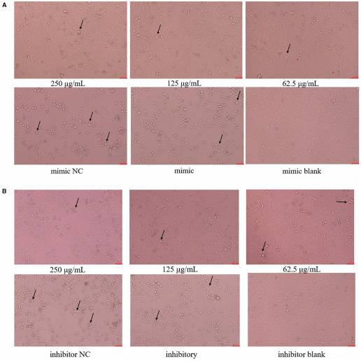 Efecto de miR-17 sobre el polisacárido Polygonum Cillinerve contra el virus de la gastroenteritis transmisible