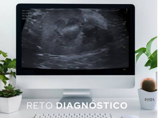 Caso: Gato geriátrico con síntomas respiratorios crónicos, al que se le ha detectado una masa pulmonar y otra asociada a una de las costillas