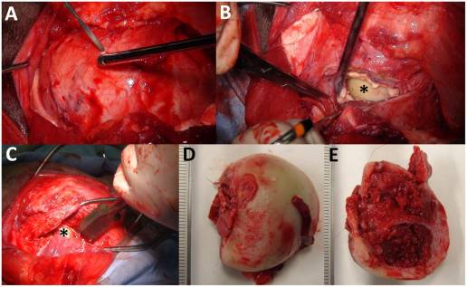 Caso clínico: Diagnóstico por imágenes de artritis séptica en la articulación de la cadera de un ternero tratado con ostectomía de cabeza femoral