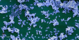 Nuevos métodos para frenar el avance de las infecciones bacterianas