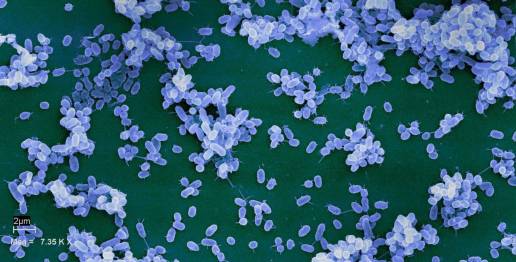 Nuevos métodos para frenar el avance de las infecciones bacterianas
