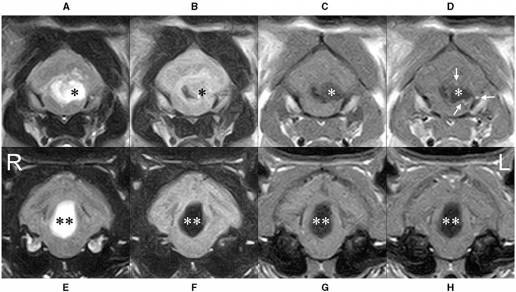 Caso clínico: Quiste epidermoide intracraneal en un gato