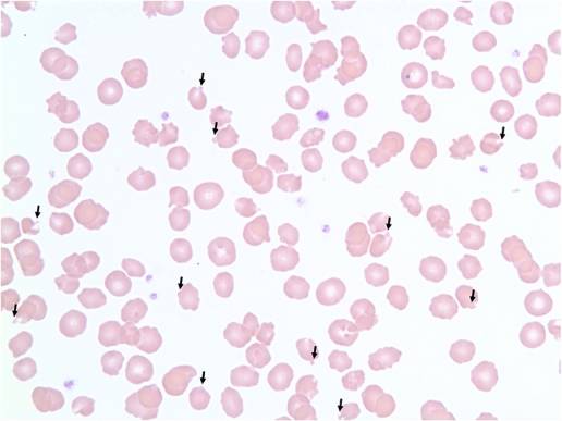 Reporte clínico de anemia con cuerpos de Heinz en un gato después de la administración repetida de propofol