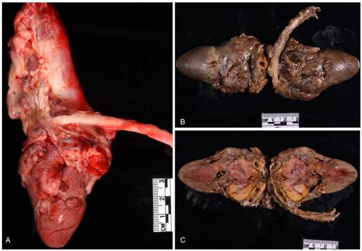 Caso clínico: quimiodectoma maligno con metástasis hepática en un gato