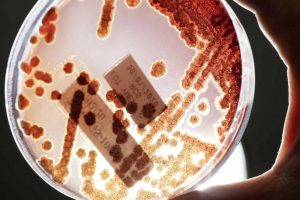 ¿Cómo frenar las resistencias antibacterianas sin crear nuevos antibióticos?