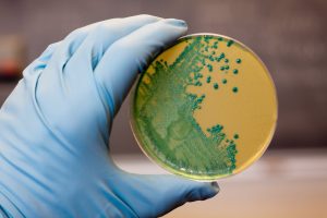 El CSIC patenta un nuevo método "más eficaz, sostenible y seguro" para combatir la listeria