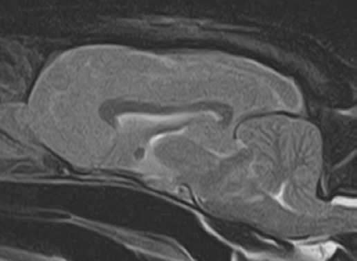 ACCIDENTES CEREBROVASCULARES MÚLTIPLES EN UN TEJÓN (MELES MELES).