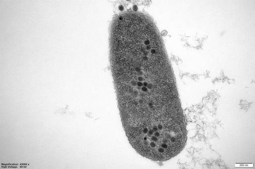 Nuevos conocimientos podrían ayudar a los fagos a derrotar a las bacterias resistentes a los antibióticos