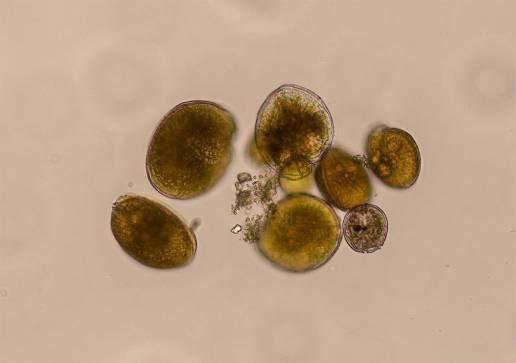 Detectan por primera vez en aguas del Mediterráneo peninsular una microalga productora de ciguatoxinas
