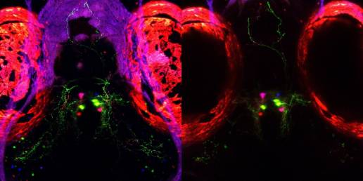 Hallado un 'interruptor biológico' del sueño en peces cebra, especie con similitudes con el cerebro humano