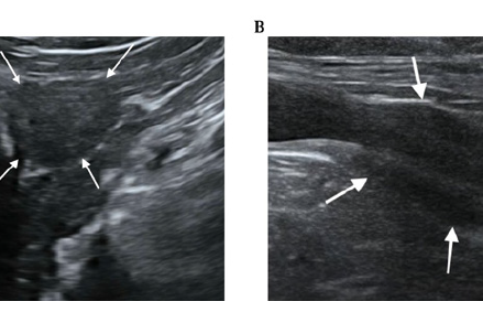 Cambios ecográficos a largo plazo de la glándula prostática canina tras la castración