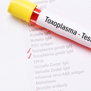 Toxoplasmosis: qué es, cómo se contagia y cómo prevenirla