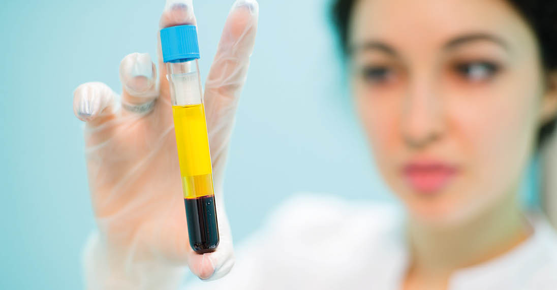 Medical cosmetology blood plasma in vitro keeps the doctor
