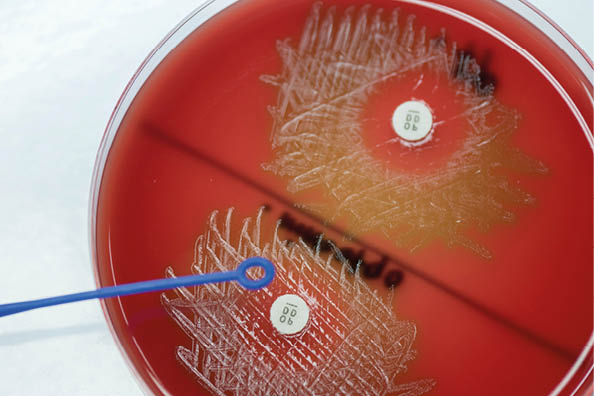 Optochin subsensitivity test on blood agar plate contains small light grains for Streptococcus pneumoniae; Focus on all agar surface  
