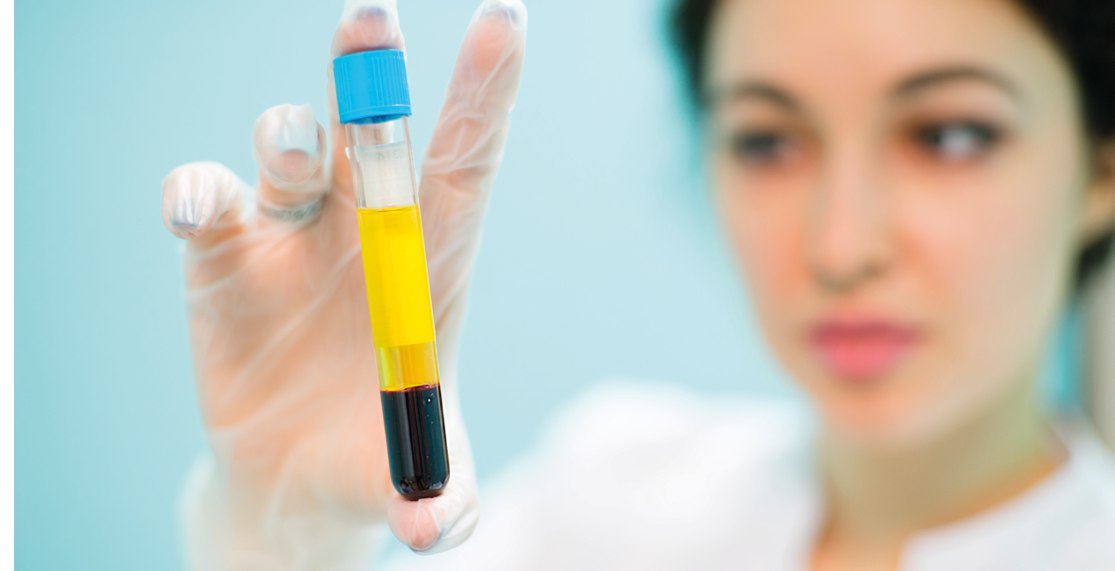 Medical cosmetology blood plasma in vitro keeps the doctor