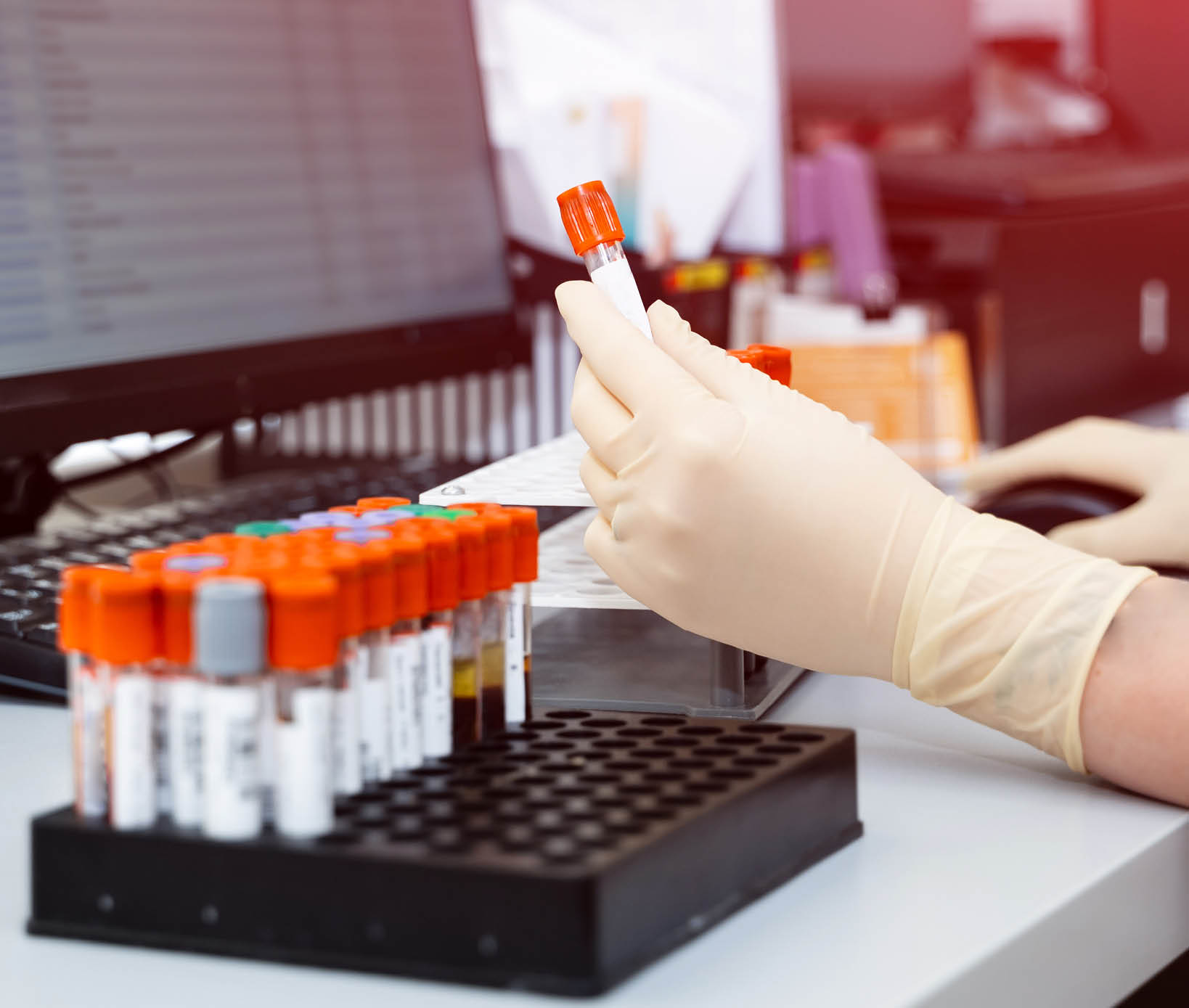 Assistant in gloves analyzing blood samples  Scientist working with blood results 