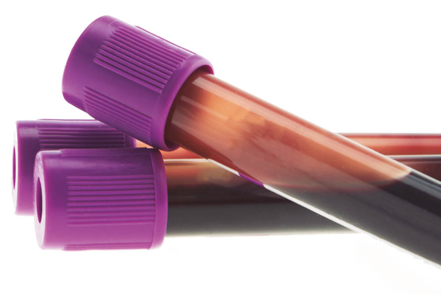 EDTA blood tube for CBC test in laboratory