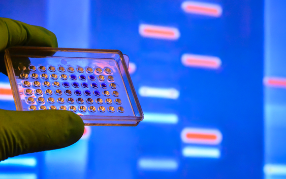 Laboratory DNA testing. Wells with biological samples on the background of electrophoretic gel.