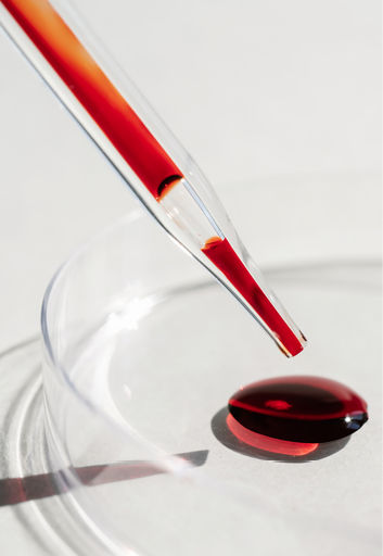 The hand holds a test tube with blood. The process of blood donation for medical tests such as covid-19 or other laboratory tests is shown.