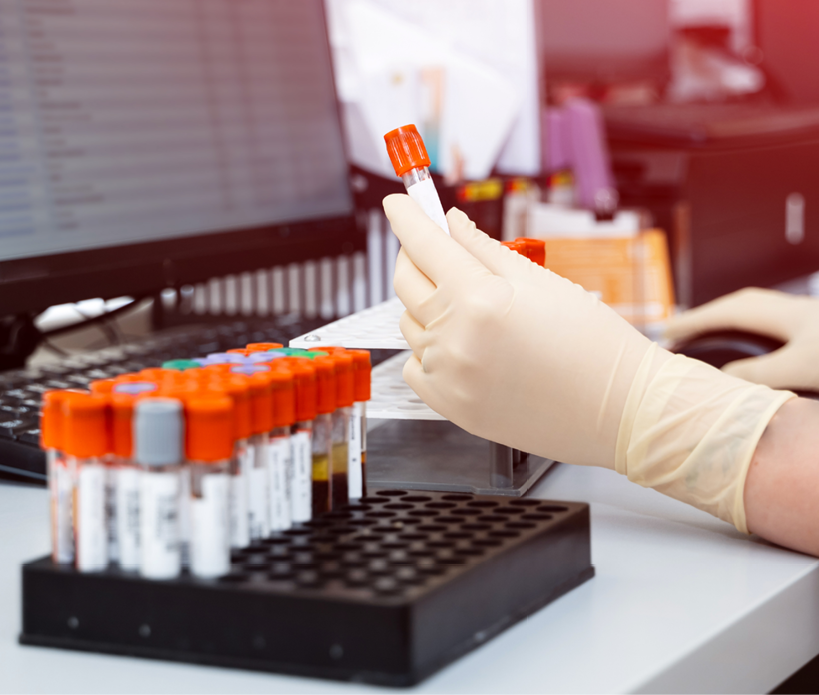 Assistant in gloves analyzing blood samples. Scientist working with blood results.
