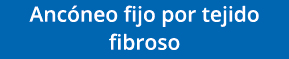 Ancóneo fijo por tejido fibroso