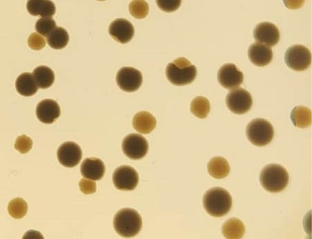 11/09/2024 Colonias de la bacteria 'Klebsiella pneumoniae' con cambios en su morfolog√≠a debido a genes que saltan desde pl√°smidos al cromosoma bacteriano SALUD   JORGE SASTRE-DOM√ NGUEZ (CNB-CSIC)  