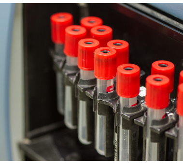 medical blood separation test centrifuge in chemical laboratory,    medicine equipment and health concept