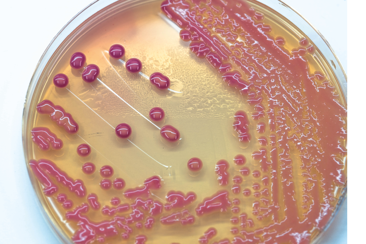 Bacterial colonies culture growth on MacConkey agar  (Klebsiella pneumoniae)contains small light grains  Focus on all agar surface   