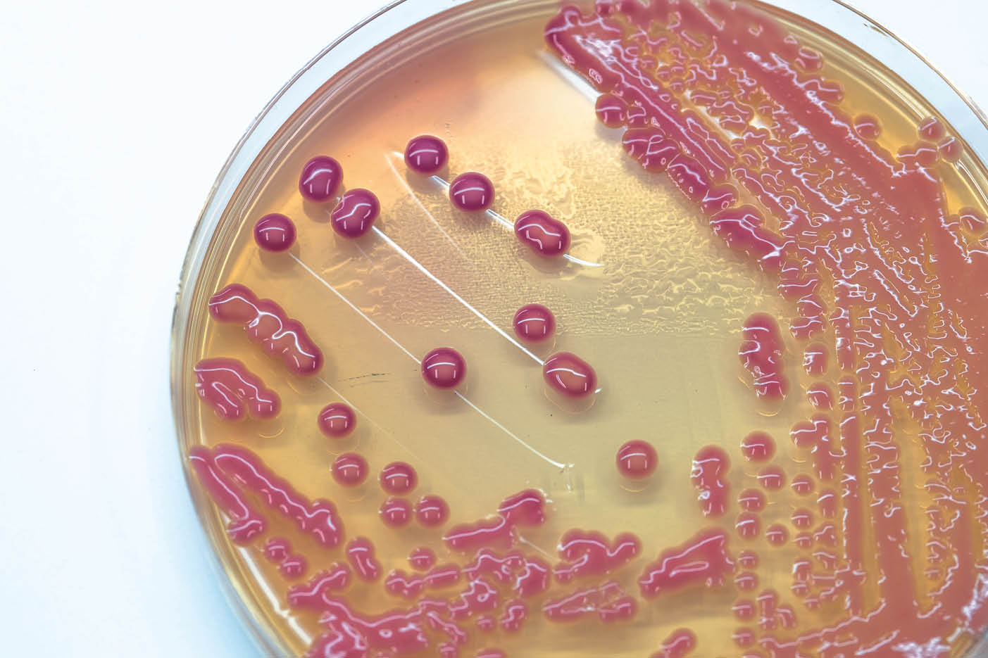 Bacterial colonies culture growth on MacConkey agar  (Klebsiella pneumoniae)contains small light grains  Focus on all agar surface   