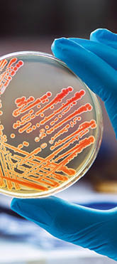 Colonies bacteria gram negative bacilli  Gram negative cocco bacilli  
