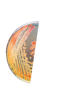 Colonies bacteria gram negative bacilli  Gram negative cocco bacilli  