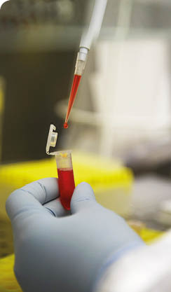 Preparaci n de conjugado de BIORAD, Laboratorio de Bacteriolog a, Departamento de Producci n y Sanidad Animal, Neiker Tecnalia, Instituto de Investigaci n y Desarrollo Agrario, Ganadero, Forestal y del Medio Natural, Derio, Bizkaia, Euskadi PR: 7475 MR: 7870